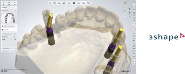 http://www.proteticke-komponenty.cz/images/3shape_cad_cam_knihovny.jpg