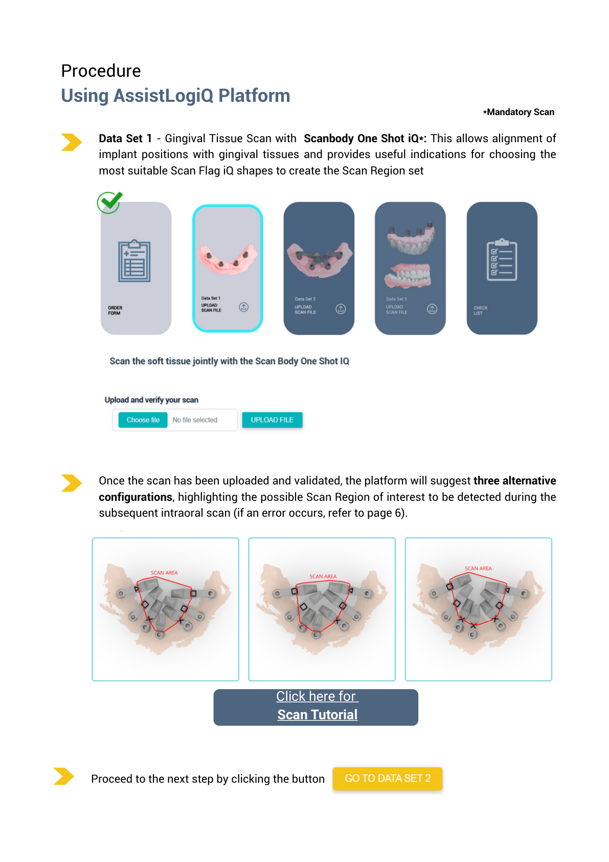 AssistLogiQ – Data Set 1: gingivální sken s One Shot iQ a návrhy konfigurací
