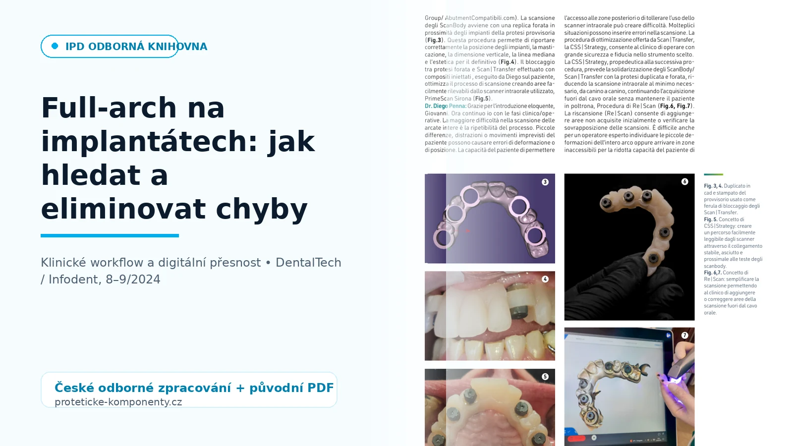Full-arch na implantátech: jak hledat a eliminovat chyby