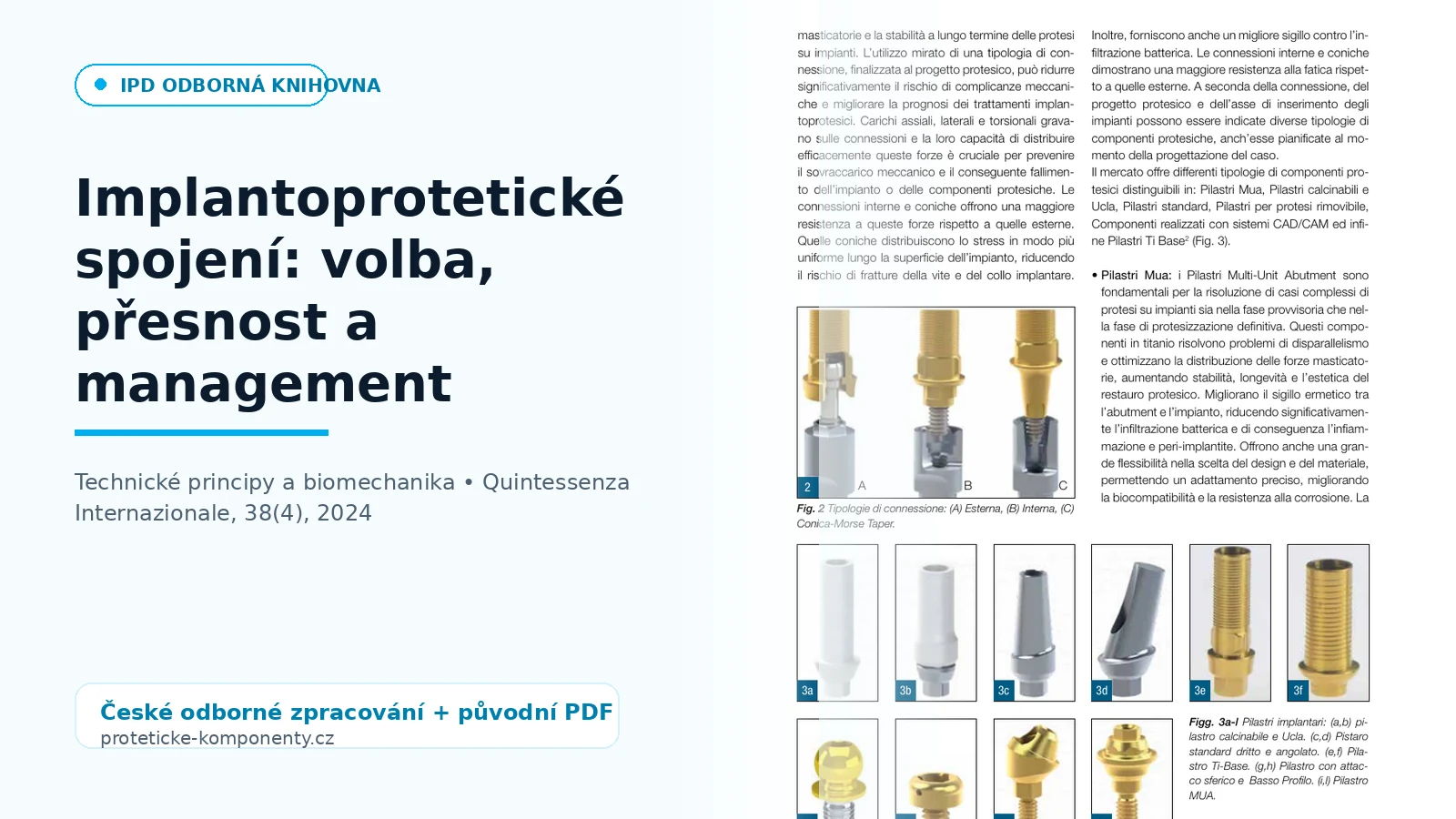 Implantoprotetické spojení: volba, přesnost a management