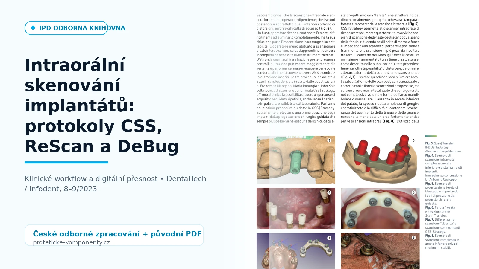 Intraorální skenování implantátů: protokoly CSS, ReScan a DeBug