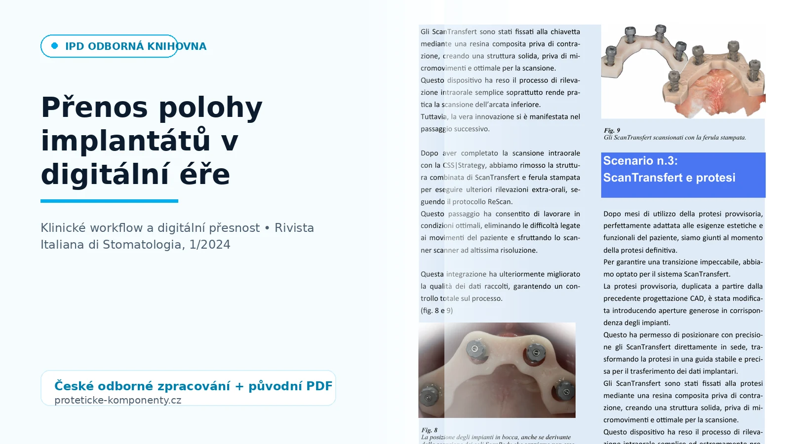 Přenos polohy implantátů v digitální éře