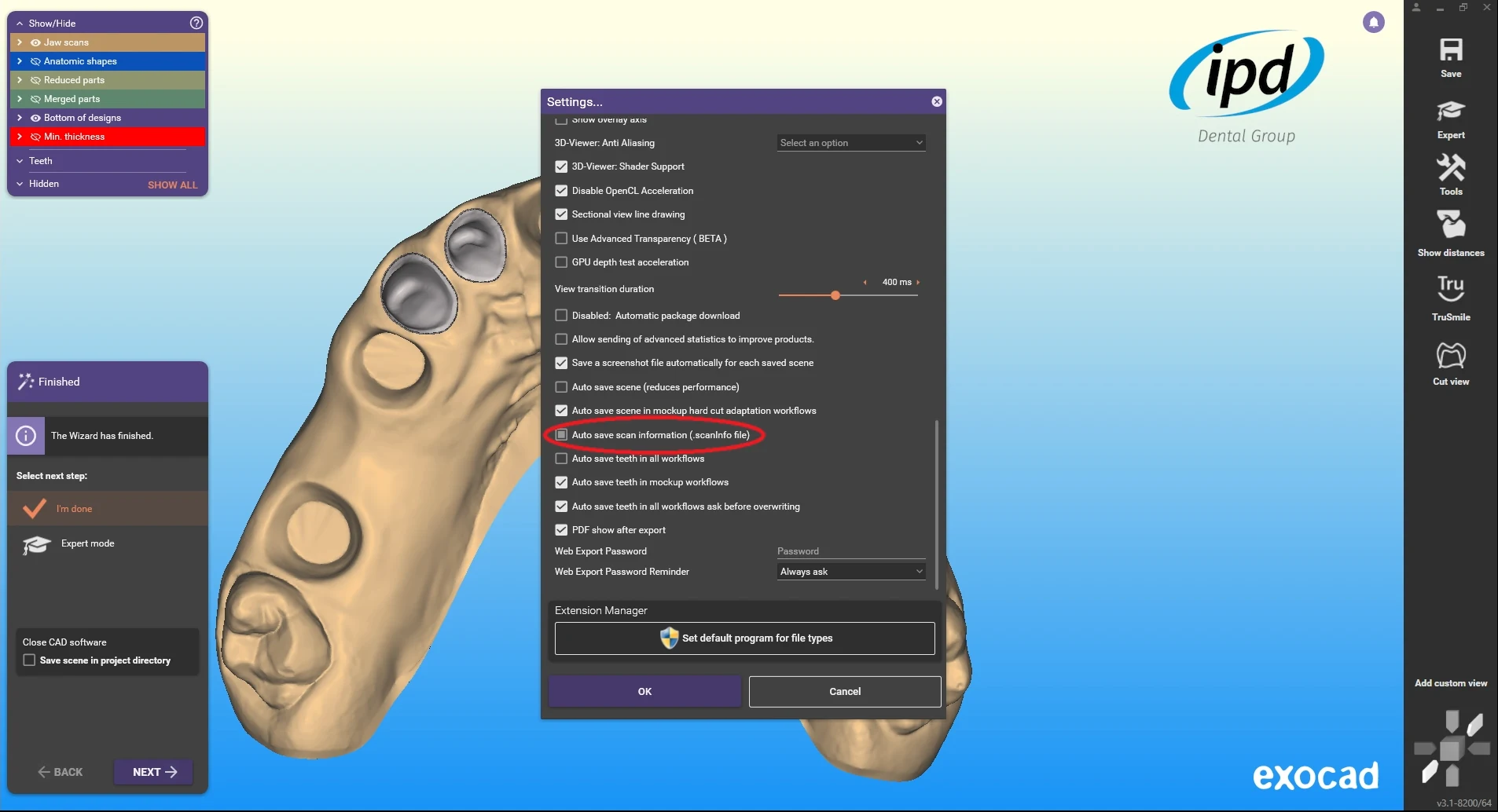 Náhled instruktážního videa: ModelPro: import preparační linie z Exocadu