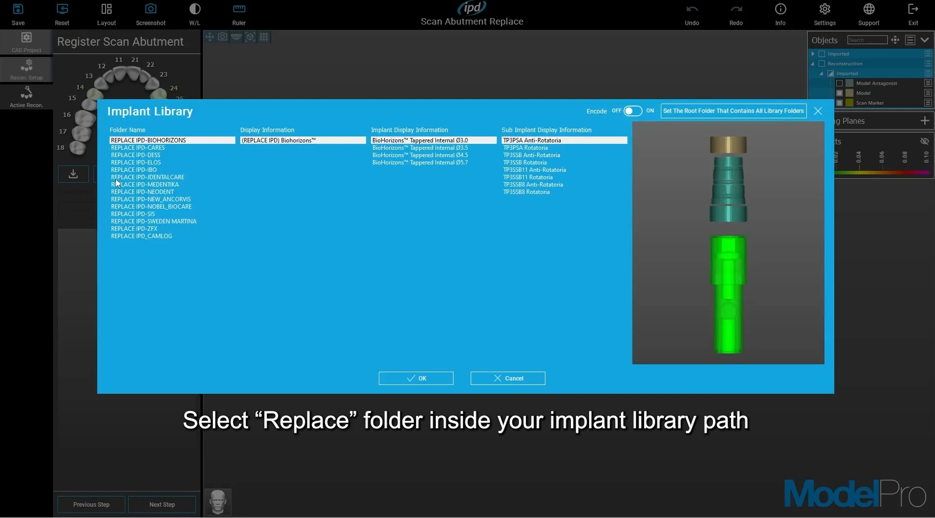 Náhled instruktážního videa: Scan Abutment Replace: výměna OEM scanbody za IPD geometrii
