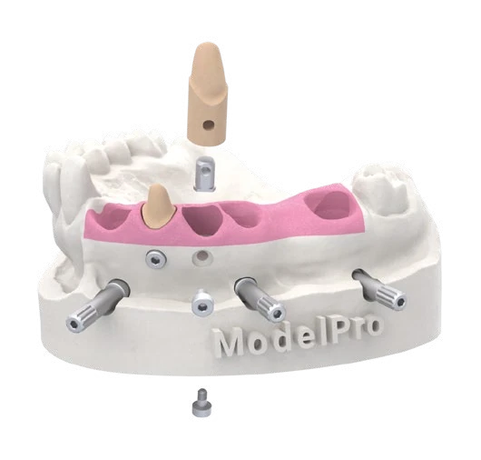 Stump Die 3D IPD – 3D tištěný dentální model s vyjímatelnými pahýly a fixačními inserty