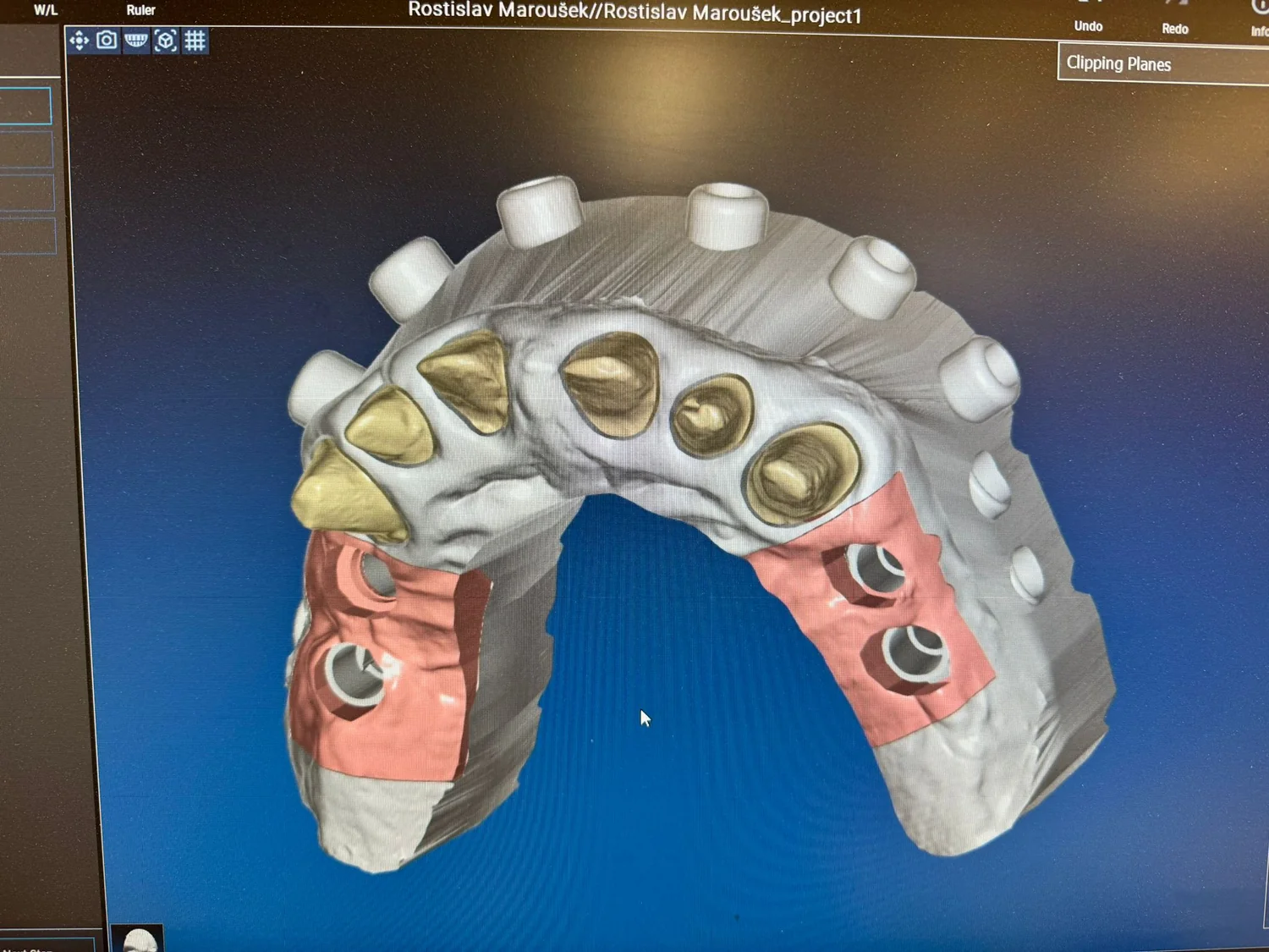 ModelPro – spodní pohled na fixační otvory Stump Die 3D
