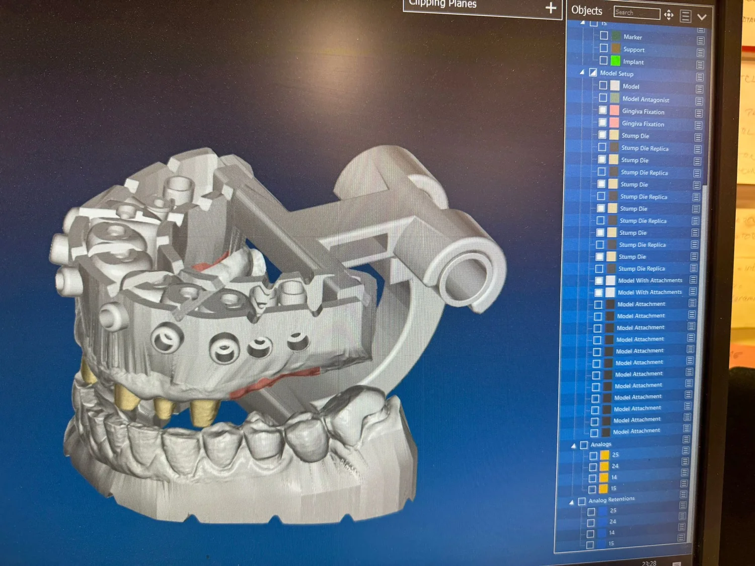 ModelPro – digitální návrh kombinovaného 3D modelu se Stump Die 3D