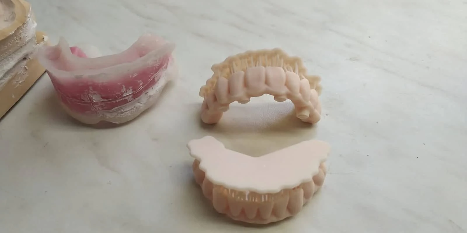 Klinický případ Scan Transfer třetí krok