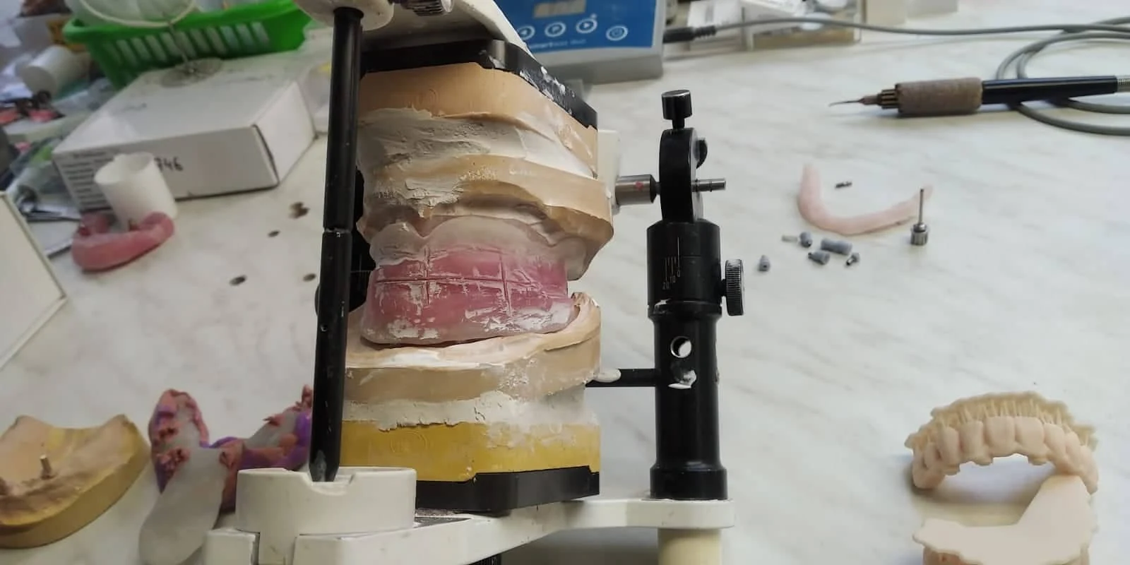Klinický případ Scan Transfer čtvrtý krok